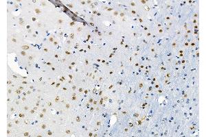 ABIN6264500 and ABIN6274041 at 1/100 staining Rat brain tissue by IHC-P.