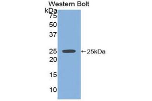 Western blot analysis of the recombinant protein. (SPRY2 Antikörper  (AA 116-304))