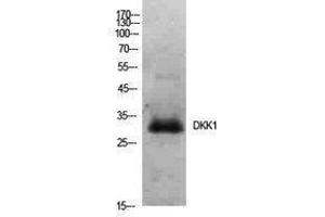 Western Blotting (WB) image for anti-Dickkopf Homolog 1 (DKK1) (Internal Region) antibody (ABIN3181416) (DKK1 Antikörper  (Internal Region))