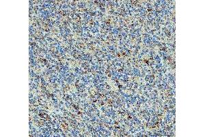 IHC analysis of PPA2 using anti-PPA2 antibody (ABIN6719431).