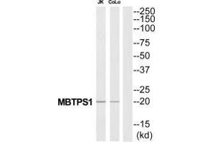 Western blot analysis of extracts from Jurkat/COLO205 cells, using MBTPS1 antibody. (MBTPS1 Antikörper  (C-Term))