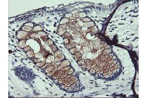Image no. 3 for anti-ADP-Ribosylation Factor-Like 5B (ARL5B) antibody (ABIN1496721)