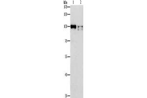 Gel: 8 % SDS-PAGE, Lysate: 40 μg, Lane 1-2: K562 cells, Jurkat cells, Primary antibody: ABIN7128244(ADAMTSL2 Antibody) at dilution 1/350, Secondary antibody: Goat anti rabbit IgG at 1/8000 dilution, Exposure time: 5 minutes (ADAMTSL2 Antikörper)