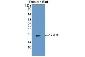 Detection of Recombinant PIP, Human using Polyclonal Antibody to Prolactin Induced Protein (PIP) (PIP Antikörper  (AA 41-139))