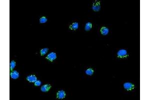 IF analysis of Giantin/GOLGB1 using anti-Giantin/GOLGB1 antibody (ABIN7600139). (Golgin B1 (GOLGB1) (AA 153-950) Antikörper)