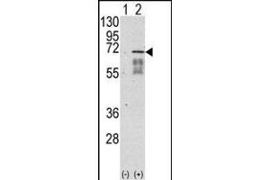 Western blot analysis of ACVR1 (arrow) using rabbit polyclonal ACVR1 Antibody (Center ) (ABIN391154 and ABIN2841264). (ACVR1 Antikörper  (AA 138-170))