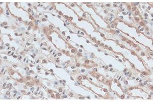 Immunohistochemistry of paraffin-embedded Mouse kidney using ZNF581 Polyclonal Antibody at dilution of 1:100 (40x lens). (ZNF581 Antikörper)