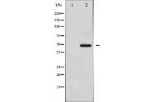 Western blot analysis of Vitamin D Receptor expression in Jurkat whole cell lysates,The lane on the left is treated with the antigen-specific peptide.