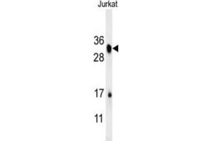 Western Blotting (WB) image for anti-R-Spondin 4 (RSPO4) antibody (ABIN3002419) (R-Spondin 4 Antikörper)