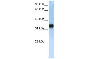 WB Suggested Anti-ZCCHC17 Antibody Titration:  0. (ZCCHC17 Antikörper  (C-Term))