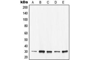 Western blot analysis of 14-3-3 epsilon expression in KNRK (A), SW480 (B), Caco2 (C), NIH3T3 (D), H9C2 (E) whole cell lysates.