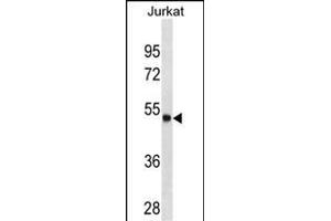 ARSA Antibody (C-term) (ABIN1536617 and ABIN2843873) western blot analysis in Jurkat cell line lysates (35 μg/lane). (Arylsulfatase A Antikörper  (C-Term))