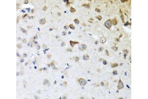 Immunohistochemistry of paraffin-embedded Mouse brain using CPA6 Polyclonal Antibody at dilution of 1:100 (40x lens). (CPA6 Antikörper)
