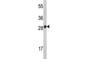 Western blot analysis of IL-2 antibody and MDA-MB231 lysate. (IL-2 Antikörper  (AA 50-77))