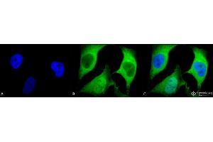 Immunocytochemistry/Immunofluorescence analysis using Mouse Anti-Ubiquitin Monoclonal Antibody, Clone 5B9-B3 . (Ubiquitin Antikörper  (HRP))