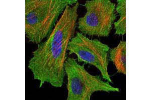 Immunocytochemistry (ICC) image for anti-TNF Receptor Superfamily, Member 6 (FAS) antibody (ABIN1845668) (FAS Antikörper)