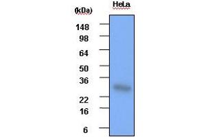 Western blot analysis: Cell lysates of HeLa(each 30ug) were resolved by SDS-PAGE, transferred to PVDF membrane and probed with anti-human Hsp27 (1:1000). (HSP27 Antikörper)