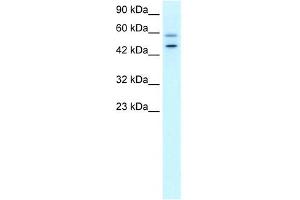 DKFZP761C169 antibody used at 0. (GC-Rich Promoter Binding Protein 1 (GPBP1) (N-Term) Antikörper)