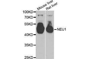 Western Blotting (WB) image for anti-Sialidase 1 (Lysosomal Sialidase) (NEU1) antibody (ABIN1980315) (NEU1 Antikörper)