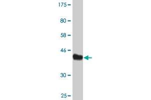 Western Blot detection against Immunogen (44. (AGR2 Antikörper  (AA 1-175))