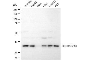 Western blotting analysis using c17orf58 antibody (ABIN7798076). (C17orf58 Antikörper)