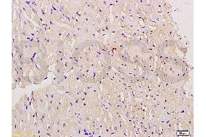Formalin-fixed and paraffin embedded mouse myocardium labeled with Anti-Myoglobin Polyclonal Antibody, Unconjugated (ABIN704381) at 1:200 followed by conjugation to the secondary antibody and DAB staining. (Myoglobin Antikörper  (AA 21-120))