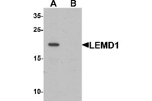 Western blot analysis of LEMD1 in A20 cell lysate with LEMD1 antibody at 1 µg/mL in (A) the absence and (B) the presence of blocking peptide. (LEMD1 Antikörper  (Middle Region))