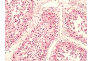 Human, Testis: Formalin-Fixed Paraffin-Embedded (FFPE) (LPAR5 Antikörper  (C-Term))