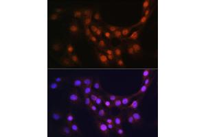 Immunofluorescence analysis of C6 cells using GMFB Rabbit pAb (ABIN6131732, ABIN6141181, ABIN6141182 and ABIN6224741) at dilution of 1:100 (40x lens). (GMFB Antikörper  (AA 1-140))