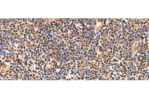 Immunohistochemistry of paraffin-embedded Human tonsil tissue using GPKOW Polyclonal Antibody at dilution of 1:140(x200)