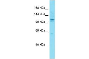 Host:  Rabbit  Target Name:  Axin1  Sample Type:  Mouse Testis lysates  Antibody Dilution:  1. (Axin Antikörper  (N-Term))