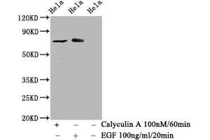 Western Blot Positive WB detected in Hela whole cell lysate(treated with Calyculin A or EGF) All lanes Phospho-RAF1 antibody at 1. (Rekombinanter RAF1 Antikörper  (pSer621))