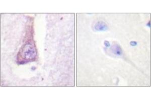 Immunohistochemistry analysis of paraffin-embedded human brain tissue, using WASP (Ab-290) Antibody. (WASP Antikörper  (AA 256-305))