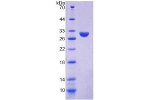 SDS-PAGE analysis of Human Ki-67 Protein. (Ki-67 Protein)