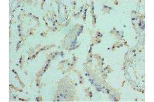 Immunohistochemistry of paraffin-embedded human prostate tissue using ABIN7152098 at dilution of 1:100