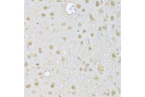 Immunohistochemistry (Paraffin-embedded Sections) (IHC (p)) image for anti-Histone Deacetylase 3 (HDAC3) (AA 299-428) antibody (ABIN3023018)