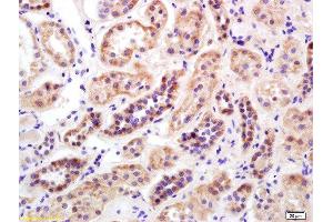 Formalin-fixed and paraffin embedded human kidney labeled with Rabbit Anti Mitofusin 2/MFN2 Polyclonal Antibody, Unconjugated  at 1:200 followed by conjugation to the secondary antibody and DAB staining (MFN2 Antikörper  (AA 1-120))