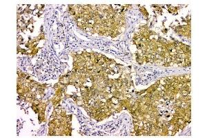 IHC analysis of STUB1 using anti STUB1 antibody (ABIN6719414).
