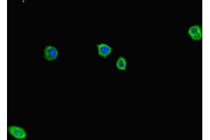Immunofluorescent analysis of HepG2 cells using ABIN7143320 at dilution of 1:100 and Alexa Fluor 488-congugated AffiniPure Goat Anti-Rabbit IgG(H+L) (ADCY1 Antikörper  (AA 416-610))