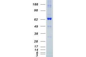 Western Blotting (WB) image for LIM Domain Kinase 1 (LIMK1) protein (Myc-DYKDDDDK Tag) (ABIN2712313)