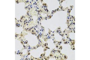 Immunohistochemistry of paraffin-embedded rat lung using GTF2H2 antibody (ABIN5975366) at dilution of 1/100 (40x lens). (GTF2H2 Antikörper)