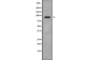 Western blot analysis SAF-A2 using HepG2 whole cell lysates (HNRNPUL2 Antikörper  (Internal Region))