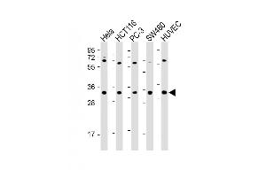 All lanes : Anti-TNFRSF6B Antibody (N-term) at 1:2000 dilution Lane 1: Hela whole cell lysate Lane 2: HC whole cell lysate Lane 3: PC-3 whole cell lysate Lane 4: S whole cell lysate Lane 5: HUVEC whole cell lysate Lysates/proteins at 20 μg per lane. (TNFRSF6B Antikörper  (N-Term))