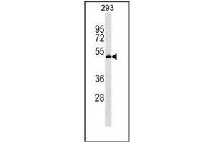 Western blot analysis of RCBTB1 Antibody  in 293 cell line lysates (35ug/lane). (RCBTB1 Antikörper  (Middle Region))