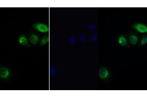 Detection of LEPR in Human Hela cell using Polyclonal Antibody to Leptin Receptor (LEPR) (Leptin Receptor Antikörper  (AA 310-539))