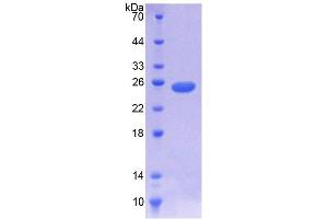 SDS-PAGE analysis of Human NOMO1 Protein.