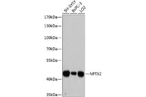 Western blot analysis of extracts of various cell lines, using NPTX2 antibody (ABIN6128350, ABIN6144791, ABIN6144792 and ABIN6215594) at 1:3000 dilution. (NPTX2 Antikörper  (AA 90-240))