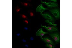 ABIN6265848 and ABIN6277175 staining  cells by IF/ICC.