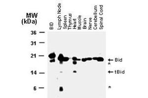 Western blot analysis of Bid in normal mouse tissues using Bid polyclonal antibody  at 1 : 2000. (BID Antikörper)
