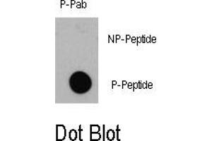 Image no. 1 for anti-Eukaryotic Translation Initiation Factor 4E Binding Protein 1 (EIF4EBP1) (pThr36) antibody (ABIN358355) (eIF4EBP1 Antikörper  (pThr36))